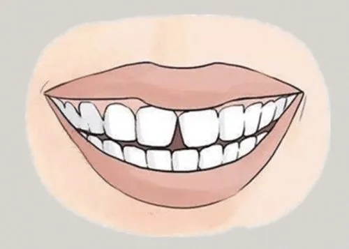 <a href=http://www.markshurysmith.com/news_article?news_id=116>一次性口腔探針</a>